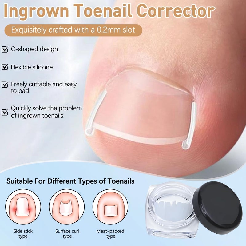 IMOLL Ingrown Toenail Corrector Set with Correction Strips,Professional Ingrown Toenails Pedicure Tool Set, Toenail Correction Strips & Ingrown Toenail Corrector,Ingrown Nail Tool for Women Man - Image 3